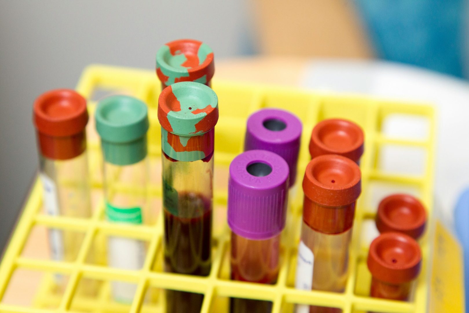 blood vials for a blood test